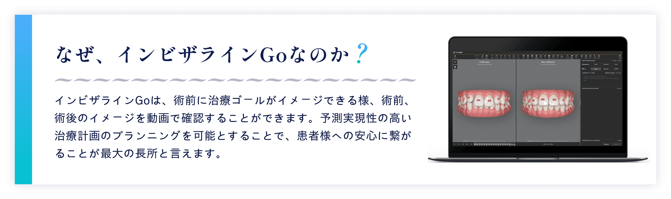 なぜ、インビザラインGoなのか？